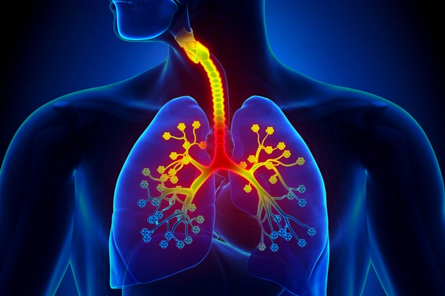 Bronşit Nedir? Kaç Gün Sürer ? Nasıl Geçer?