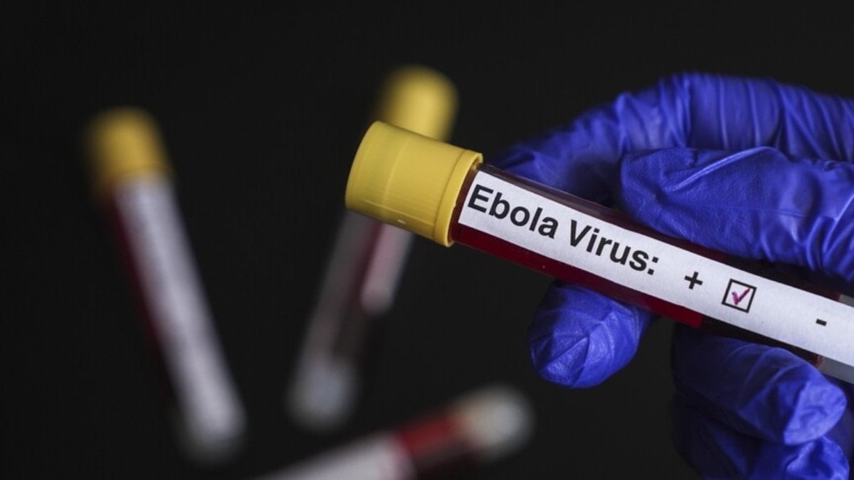 Fransa ilk Ebola vakasını açıkladı