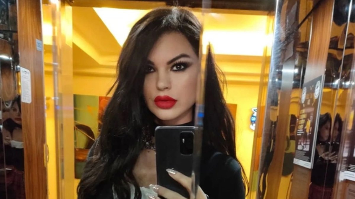 Şarkıcı Nez’den estetik açıklaması: Benim ihtiyacım yokmuş