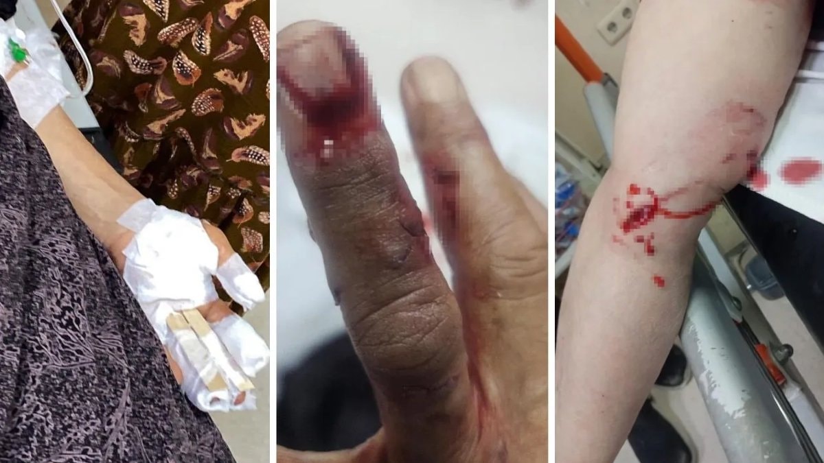 Şırnak’ta başıboş köpeklerin saldırdığı kadınlar hastanelik oldu