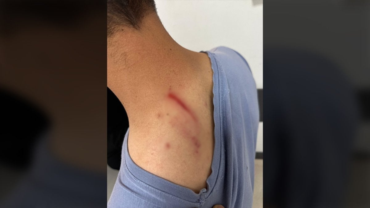 Diyarbakır’da ilaç raporu tartışmasında tıbbi sekreter darbedildi