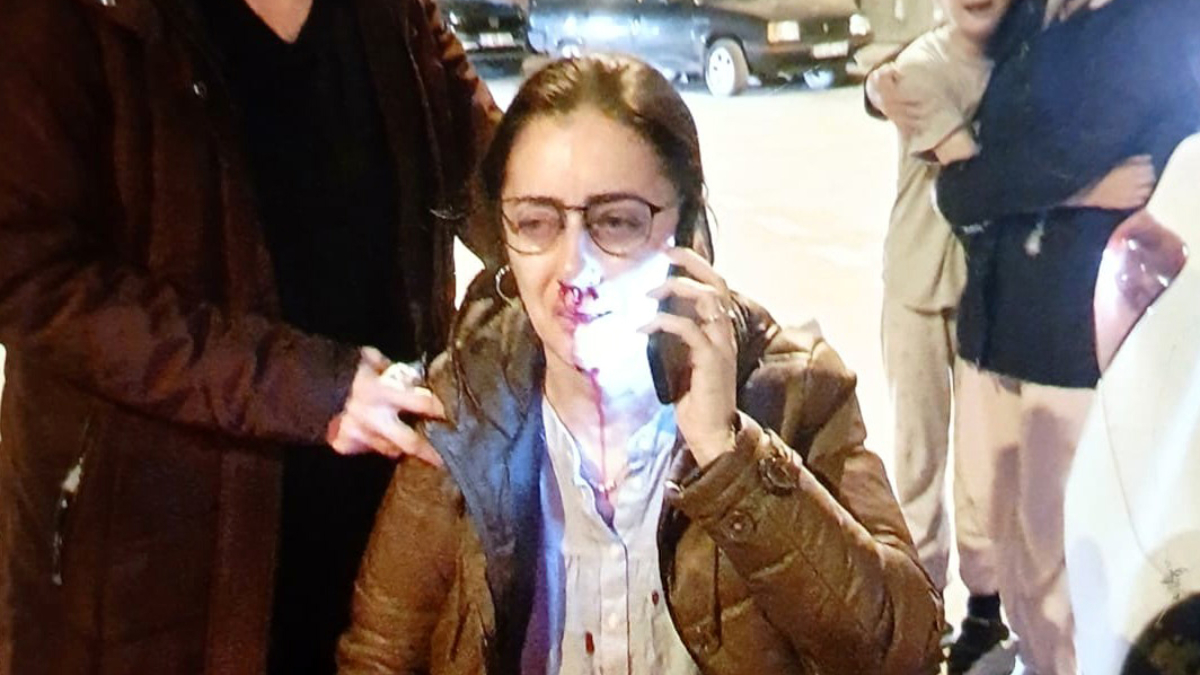 Edirne’de eşinin sevgilisi sandığı kadını darbettiği otomobil kapısı ‘silah’ sayıldı