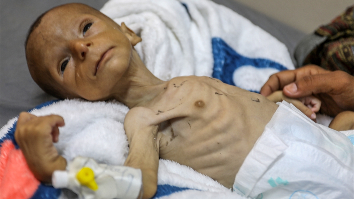 Gazze ‘felaketi’ yaşıyor: 2 aylık bebeğin yaşamı tehdit altında