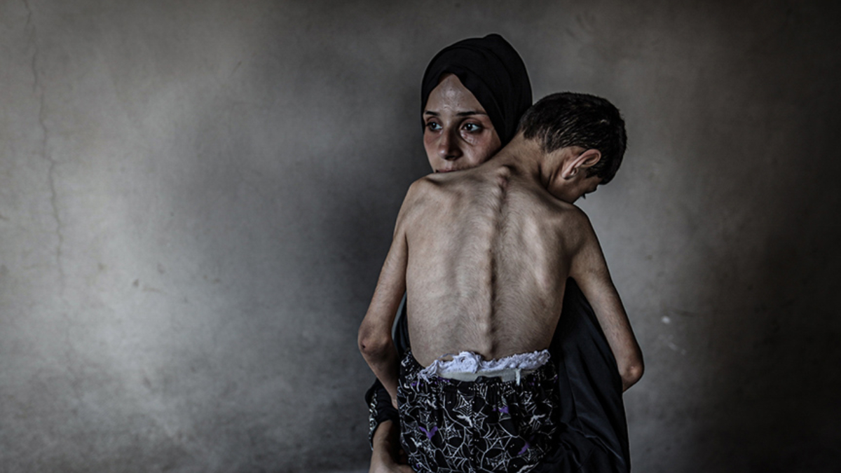 Gazze’de kıtlık: Son 24 saatte 4 sivil daha açlıktan hayatını kaybetti