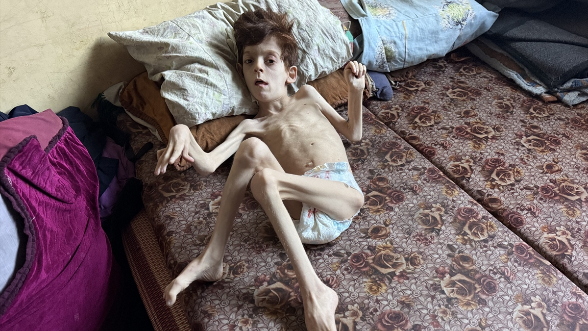 Gazze’de insani kriz: Filistinli çocuğun yaşamı tehdit altında