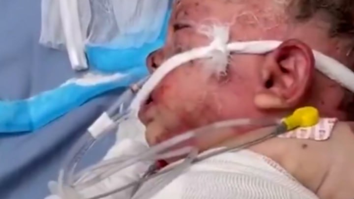 İsrail zulmünün utanç karesi: Gazze’de 10 aylık bebek ağır yaralandı