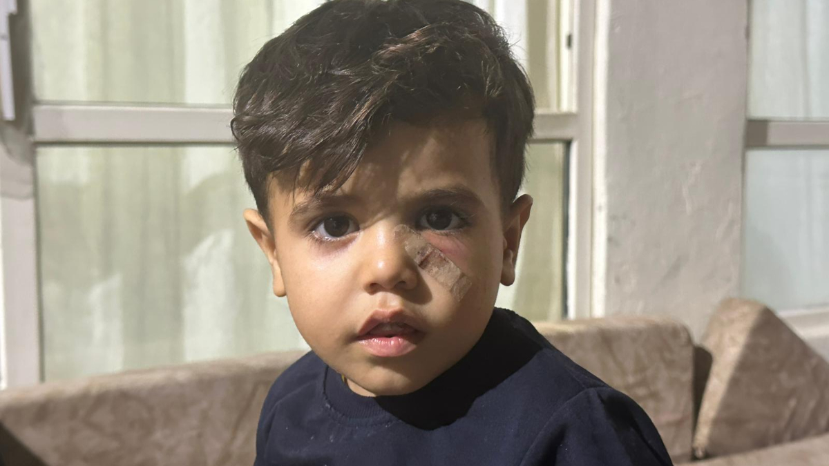 Şanlıurfa’da yorgun mermi çocuğun gözünün altına isabet etti