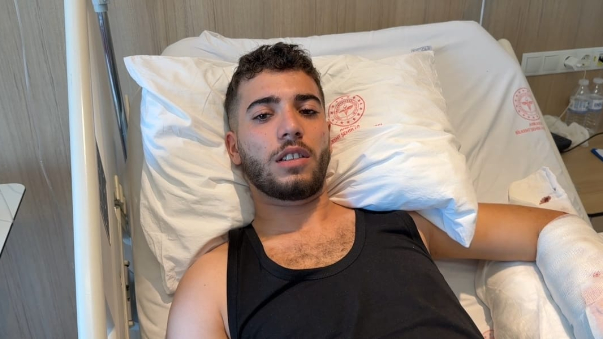 Ankara’da çalıştığı iş yerindeki köpeğin saldırısına uğrayan adam yaralandı